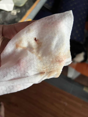 Mucus plug ?