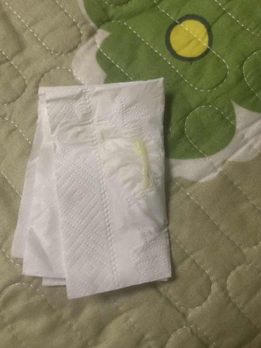mucus plug atau keputihan?