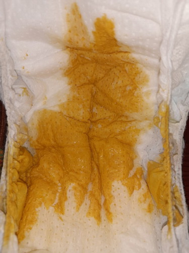 ลูกถ่ายเหลว