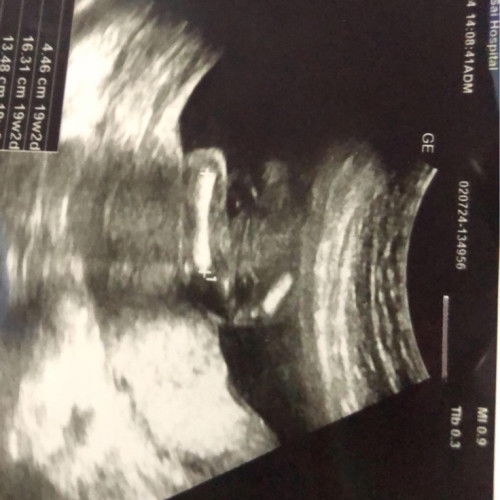 แม่ๆช่วยกันดูหน่อยค่ะลุ้นมาก