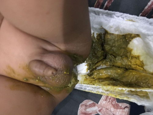 Diare pada bayi 5 bulan 22 hari