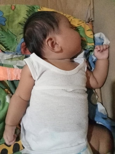 Pa Advice Naman Po Mag 3month napo si baby then problem kopo is disya nakakadumi3weeksbreastfeed po