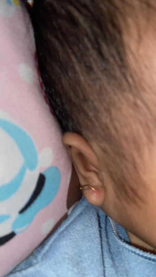 Lobang tindikan merah