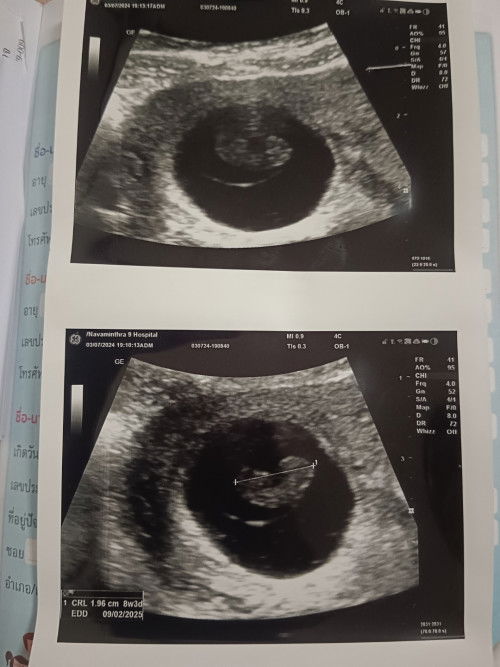 ไม่เจอหัวใจน้อง