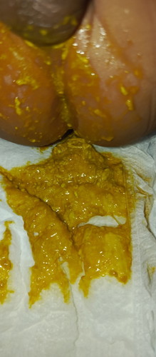 Normal po ba sa 2months old breastfeeding baby ?