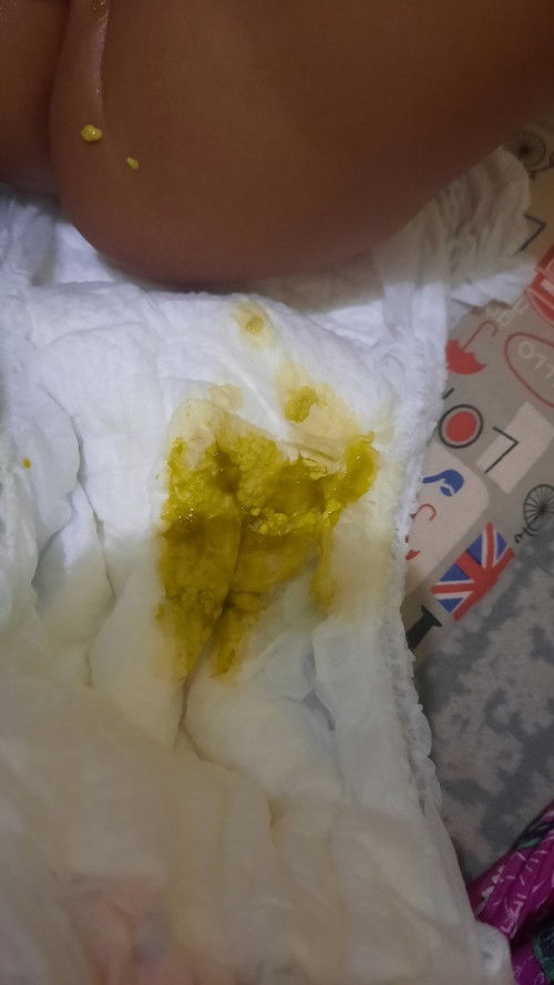 FASES BAYI 5BULAN 1HARI