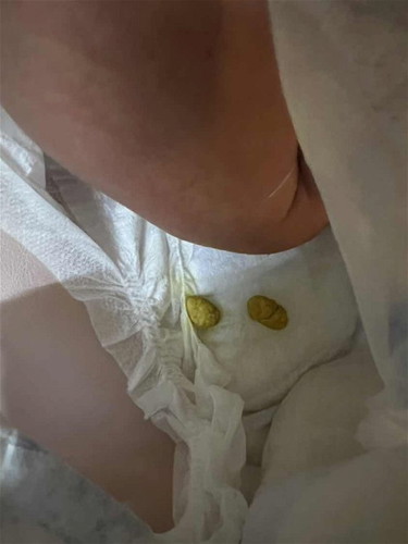 Najis bayi newborn