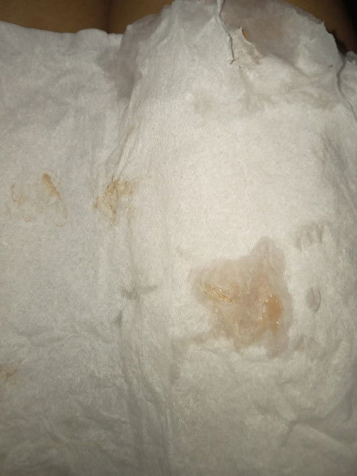 Flek coklat muda di 6w5d