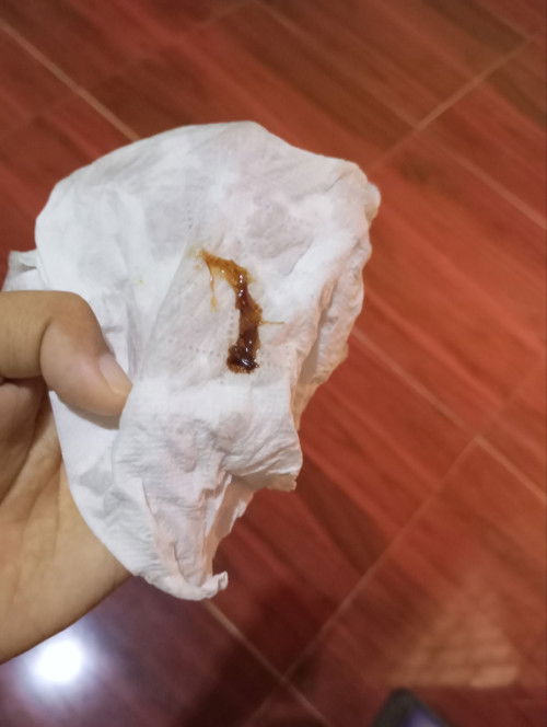 ใช่มูกเลือดมั้ยค่ะ