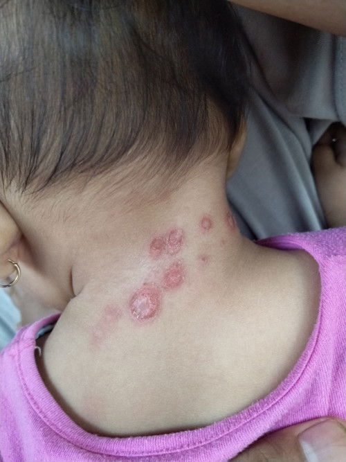 Bun adakah yang pernah mengalami seperti ini anaknya? Kira" obatnya apa ya?