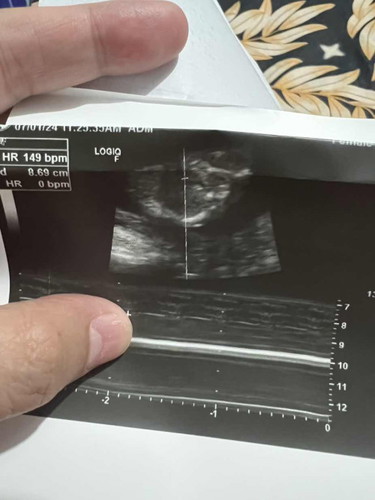 Baby Gender