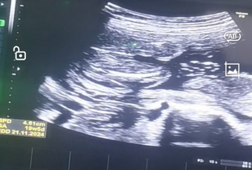 ทายเพศลูก
