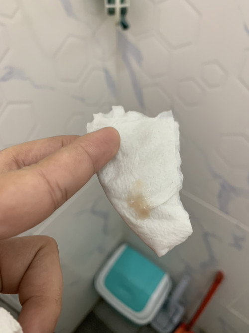 Mucus plug 8weeks pregnant