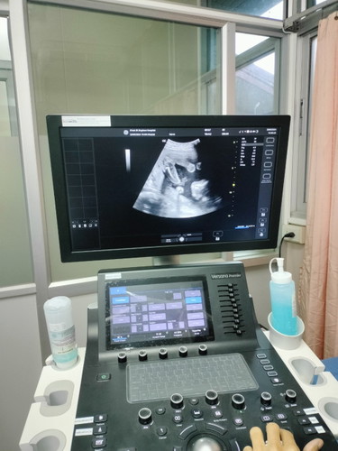 แม่ๆ ว่าลูกสาวหรือลูกชายค่ะแบบนี้
อัลตราซาวด์ตอน 20 สัปดาห์