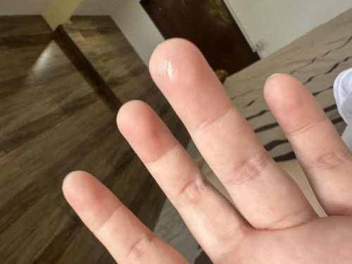 ช่วยดูหน่อยค่ะเป็นแบบนี้ใช่น้ำคร่ำรั่วไหมคะ บางทีน้ำใสๆ บางทีใสๆขุ่นๆแต่ออกมาเยอะอยู่ในแต่ละวัน