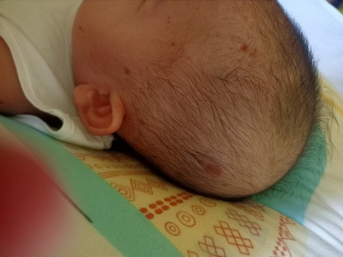 Red Dots on skin