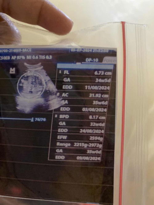 BPD dan AC selisih 3 minggu (lebih besar AC)