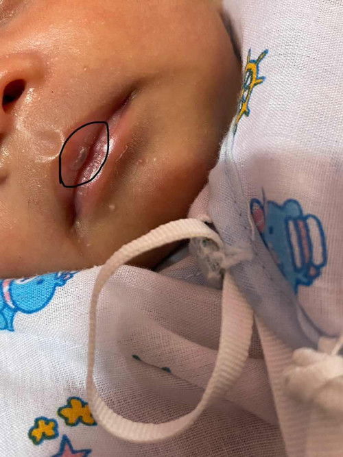 ขออนุญาตถามแม่ๆนะคะ