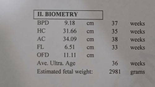 Biometry FL. IS IT NORMAL?