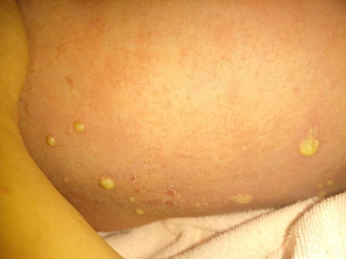 Bun ada yg tau ini obatny apa