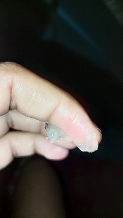 Bund tanya dong 37 week ada lendir kaya gni gak berbau tapi lengket kenapa ya