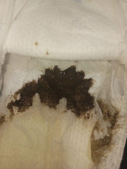 Poop 1 year old