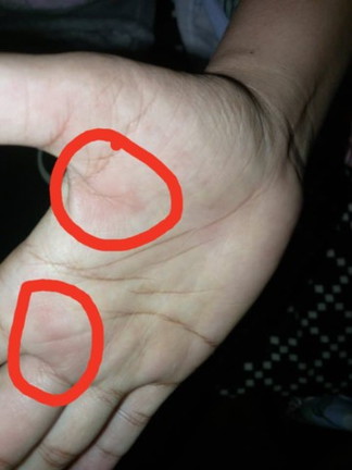 Hello mga mi.pahelp po. After ko manganak, Makati, masakit at parang namaga palad Ng kamay ko.