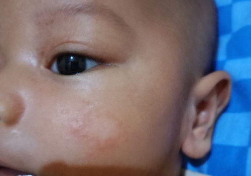 Minta solusinya dong bun