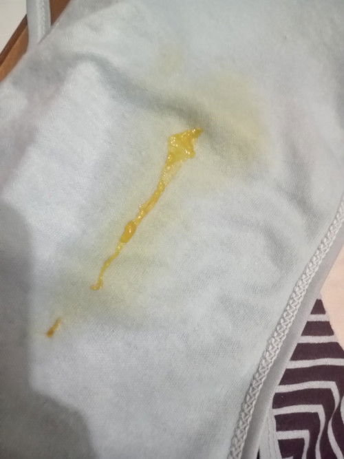 Mom mau tanya bayi sebulan pup kaya gini kenapa ya ? Ada yang sama ngga