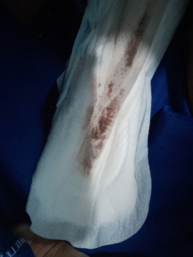 PAGDUGO AFTER MANGANAK