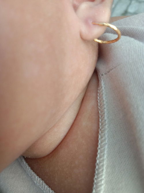 Bintik putih di dagu, leher dan dada