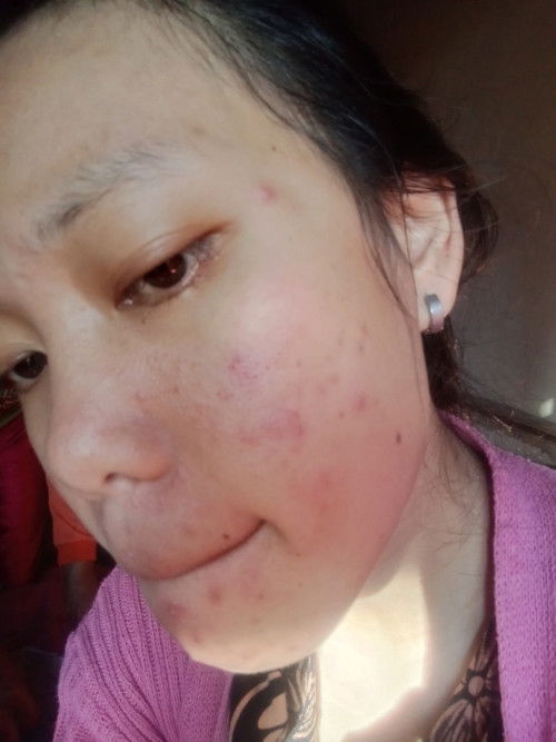 Skincare aman bumil busui