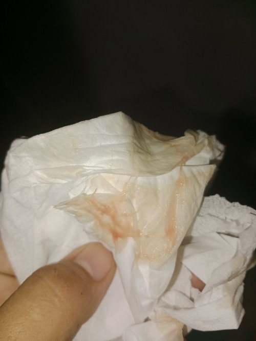 tanda persalinan atau bukan yah