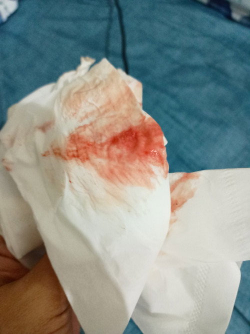 Normal ke lepas bersama keluar darah? Sebab xde rasa sakit apa apa..cuma kluar darah..11week 4day