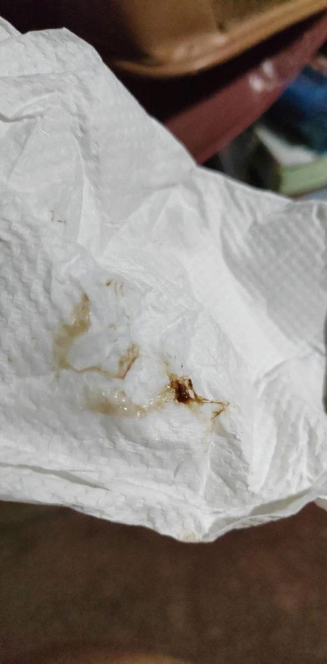 39 weeks and 2 days na po ako. Kahapon ng gabi may lumabas na ganitu sakin. Manganganak na ba ako?