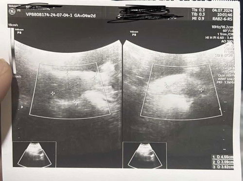 Ada yang sama tidak bunda bunda