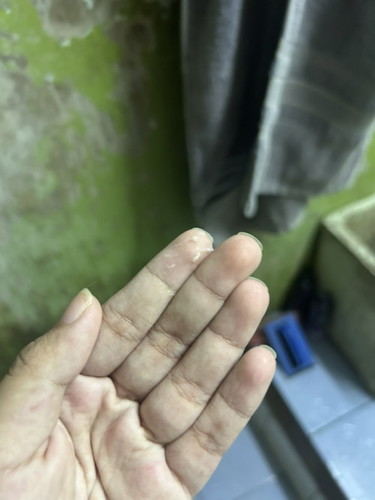 ใช่มูกใสไหมคะแม่ๆ