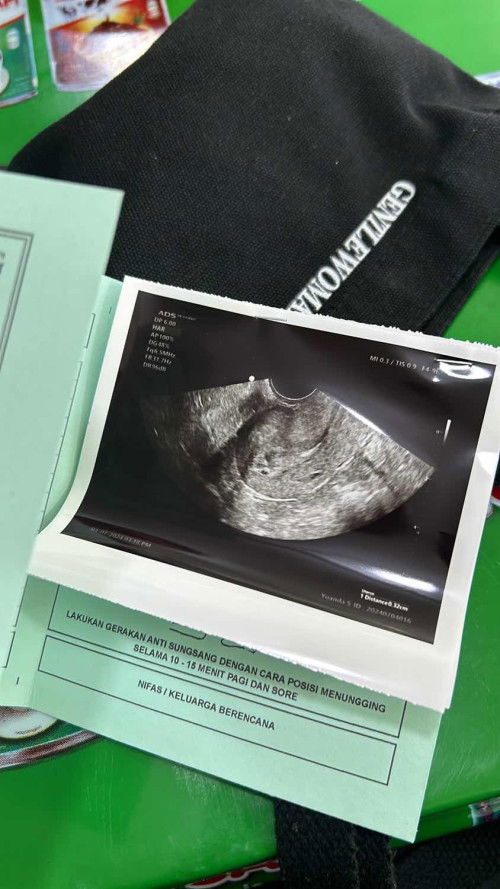 Baru pertama kali hamil