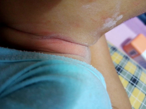 Nak tanya pasal ruam. Anak umur 4bulan++