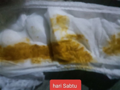 Bun mau nanya