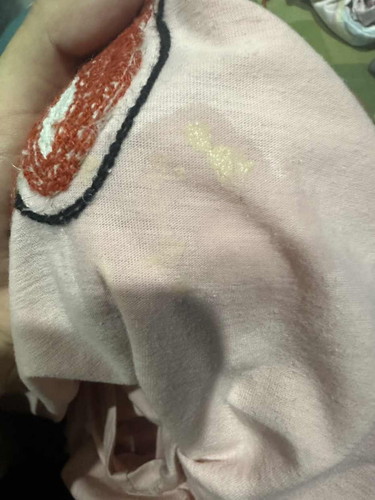 เต้านมอักเสบ