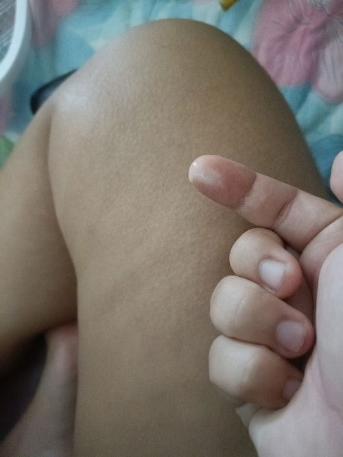 36W มีน้ำใสๆแบบนี้ เรียกตกขาวหรือป่าวคะ