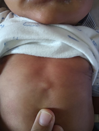 Sino same case sa newborn nyo?