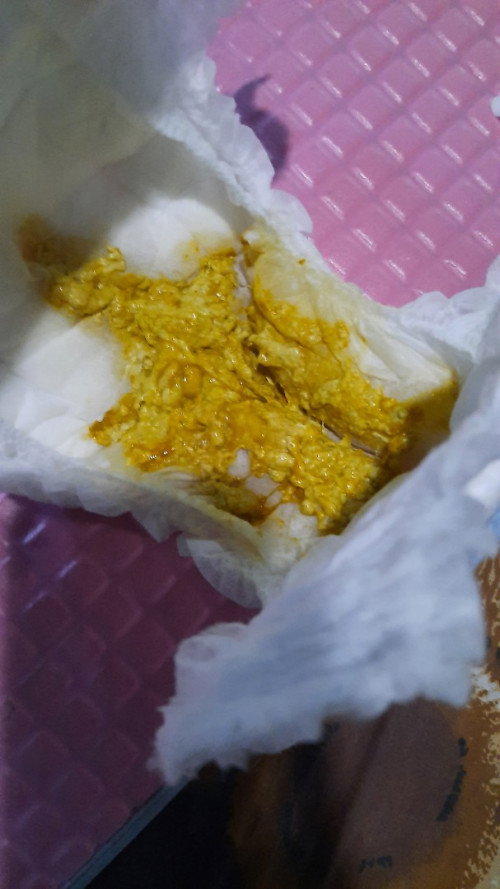 Bab bayi usia 4 bln berlendir, apakah normal ?