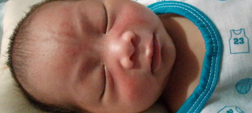 Ilang weeks kaya Bago matanggal ang mga acne ni baby.
12 days palang po sya.
