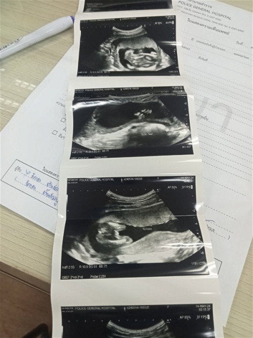 อยากทราบเพศลูก