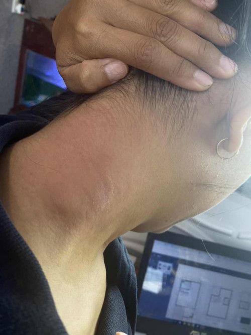 Gatal di bagian leher