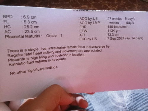 pwede ba magkamali sa gender ng baby sa Ultrasound Pag naka suhi si baby