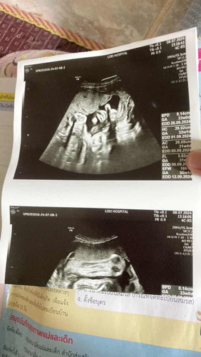 แม่ๆคลอดเดือนไหนกันคะ