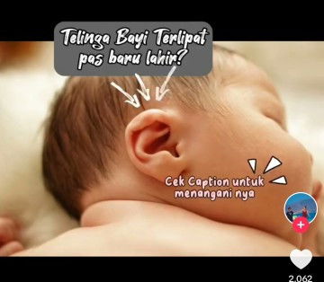 Daun telinga terlipat